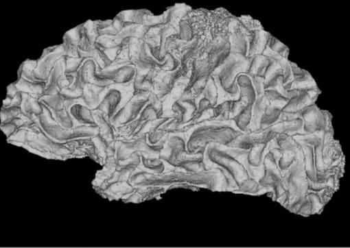 FreeSurfer reconstruction of a cortical white-matter surface.