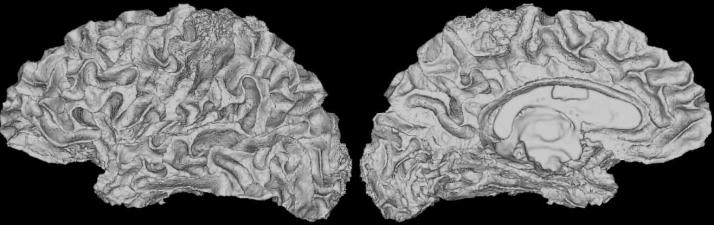 A cortical surface reconstruction, both hemispheres, rendered on black — from the cognitive-control ontology work.